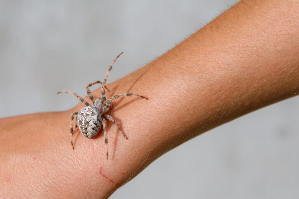 how to treat a spider bite at home